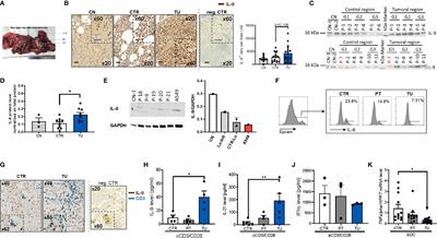 IL-9 Producing Tumor-Infiltrating Lymphocytes and Treg Subsets Drive Immune Escape of Tumor Cells in Non-Small Cell Lung Cancer